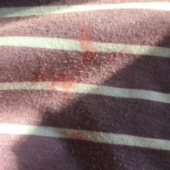 Violet Striped Dress w pockets - Picture 2 of 6